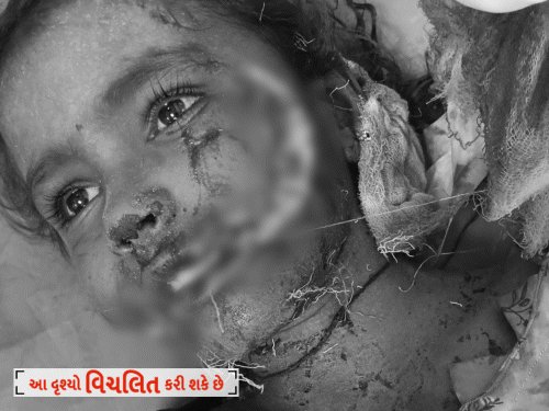 પાટણના વૌવા ગામમાં વન્યપ્રાણીનો હુમલો: 15થી વધુ ઘાયલ, 3ની હાલત ગંભીર