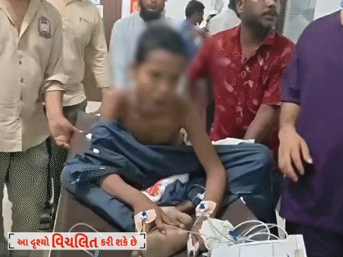 સુરત: મદરેસાના બીજા માળેથી પડેલા બાળકના ખભા-મોઢામાં લોખંડનો સળિયો, સિવિલ હોસ્પિટલમાં ઓપરેશન