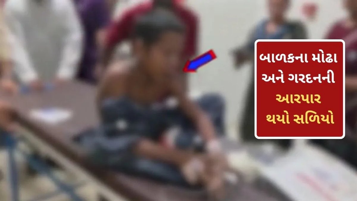 સુરતમાં ત્રીજા માળેથી પડેલા 13 વર્ષના કિશોરના ગળામાં સળિયો ઘૂસ્યો